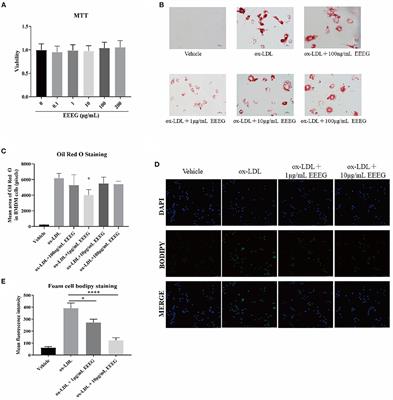 The ethanol extract of Edgeworthia gardneri (Wall.) Meisn attenuates macrophage foam cell formation and atherogenesis in ApoE−/− mice